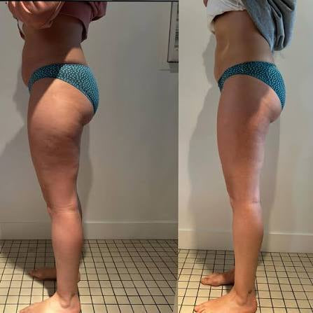 Deux vues de jambes côte à côte.
